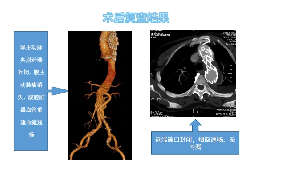 图片93.png