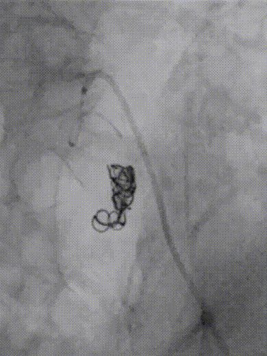 2.gif