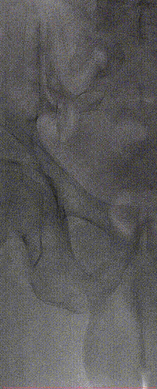 2.gif
