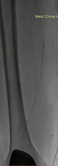 12.gif