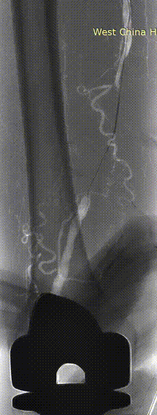 6.gif