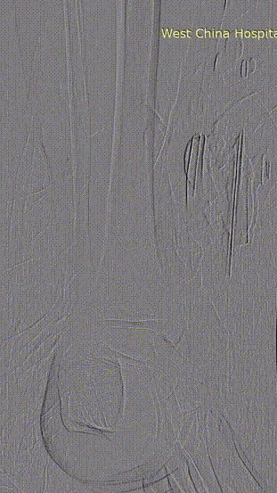 5.gif