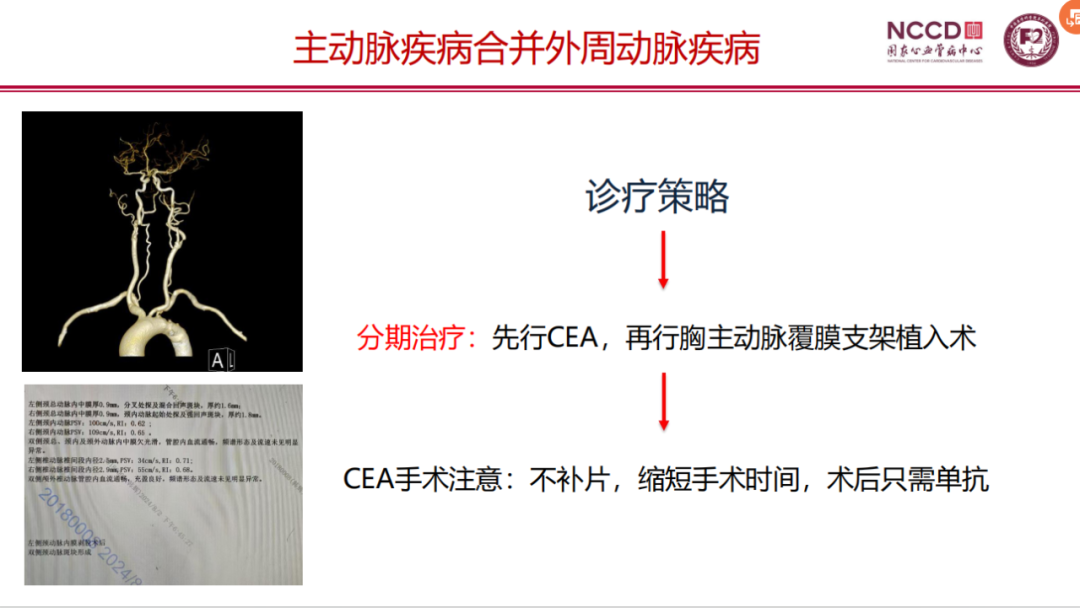 7a374bd0c27e55b60e6580f2d5fe99d9.png