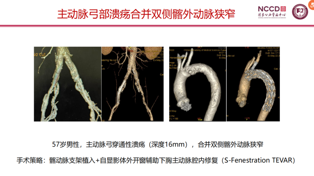 d55142e16899d5519484c214e9df4446.png