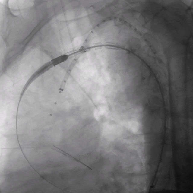 2.gif