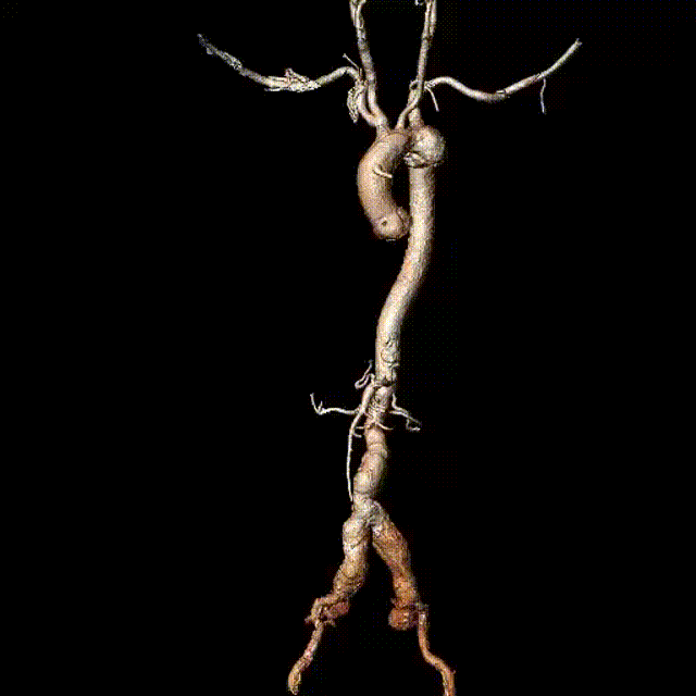 2.gif